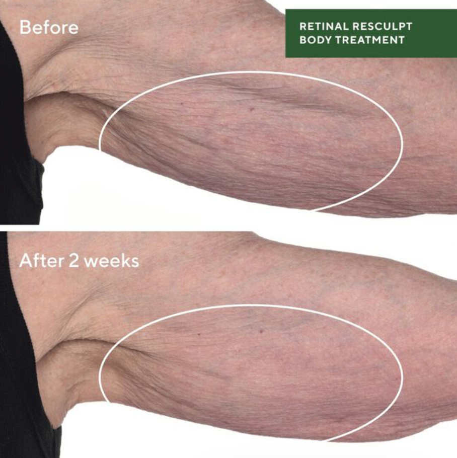 Retinal Resculpt Body Treatment