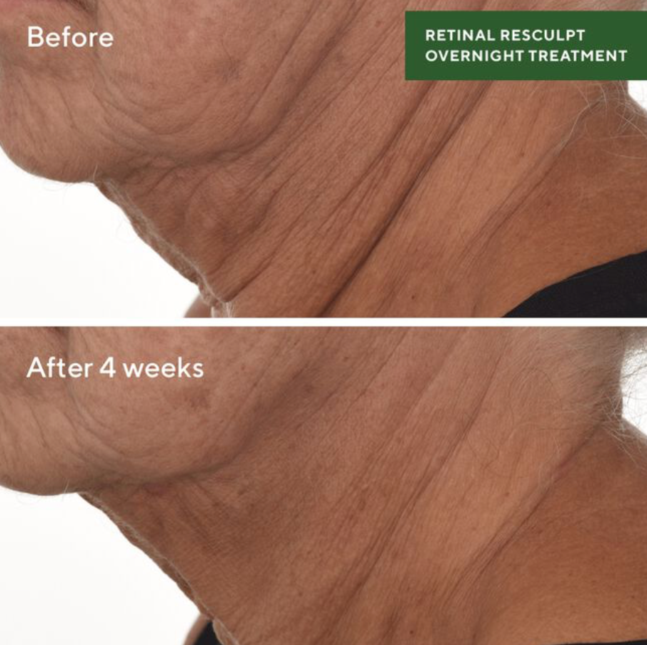 Retinal ReSculpt Overnight Treatment