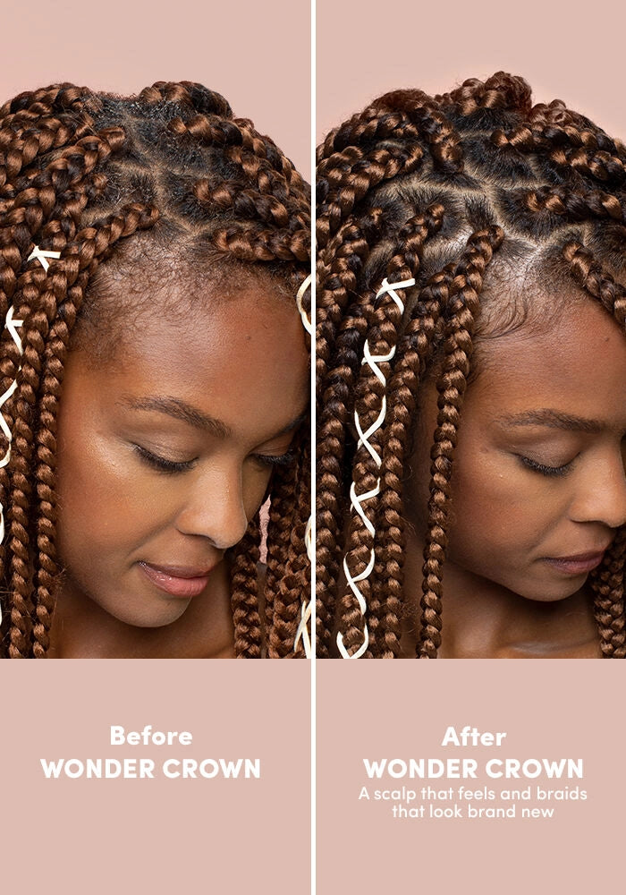 MIZANI Wonder Crown Scalp Foaming Pre-Cleanse - Style Shifter Society