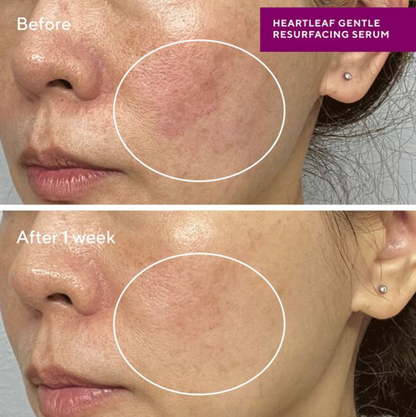 Heartleaf Resurfacing Serum