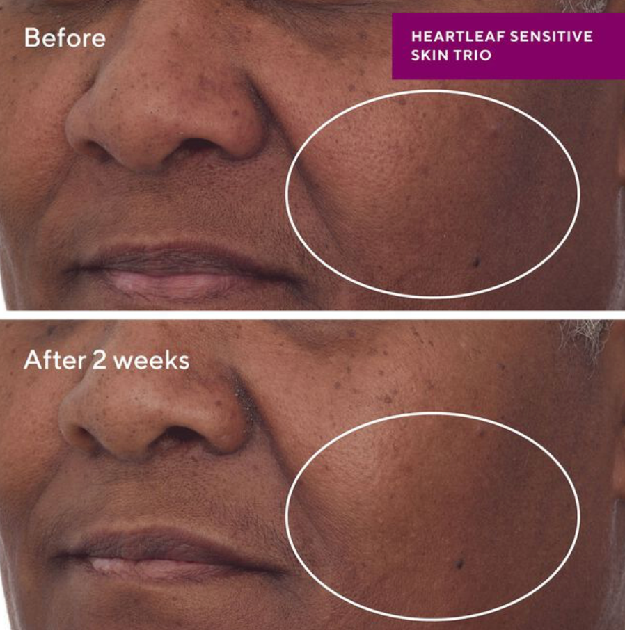Heartleaf Calming Cream