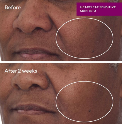 Heartleaf Calming Cream