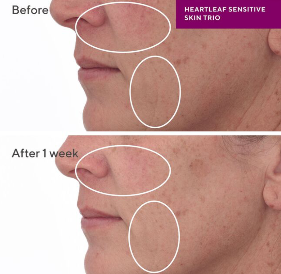 Heartleaf Soothing Cleanser