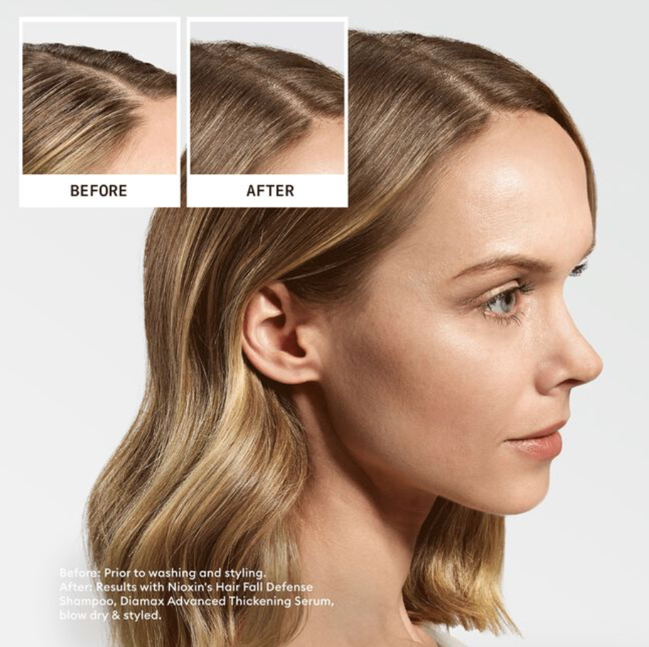 Ultimate Power Hair Fall Defense Shampoo
