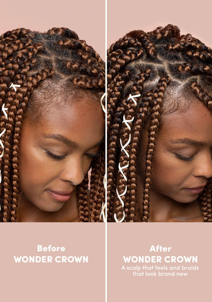 MIZANI Wonder Crown Scalp Foaming Pre-Cleanse - Style Shifter Society