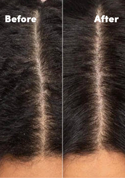 MIZANI Scalp Care Anti-Dandruff Conditioner