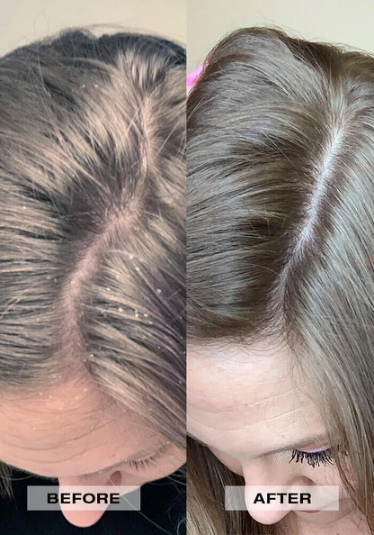 L'ANZA Scalp Balancing Cleanser