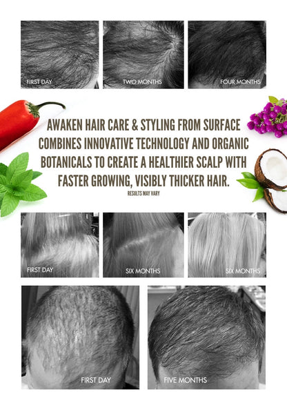 Surface Awaken Therapeutic Masque