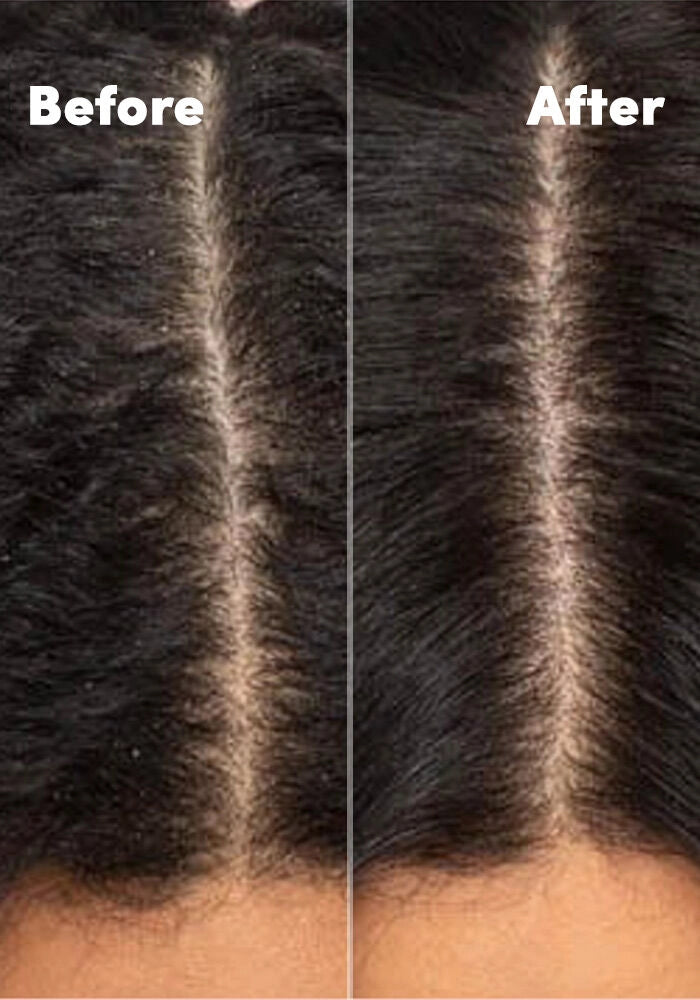 MIZANI Scalp Care Scalp Calming Lotion
