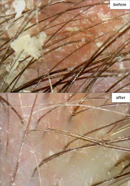 Briogeo Scalp Revival Charcoal + Coconut Oil Micro-Exfoliating Shampoo