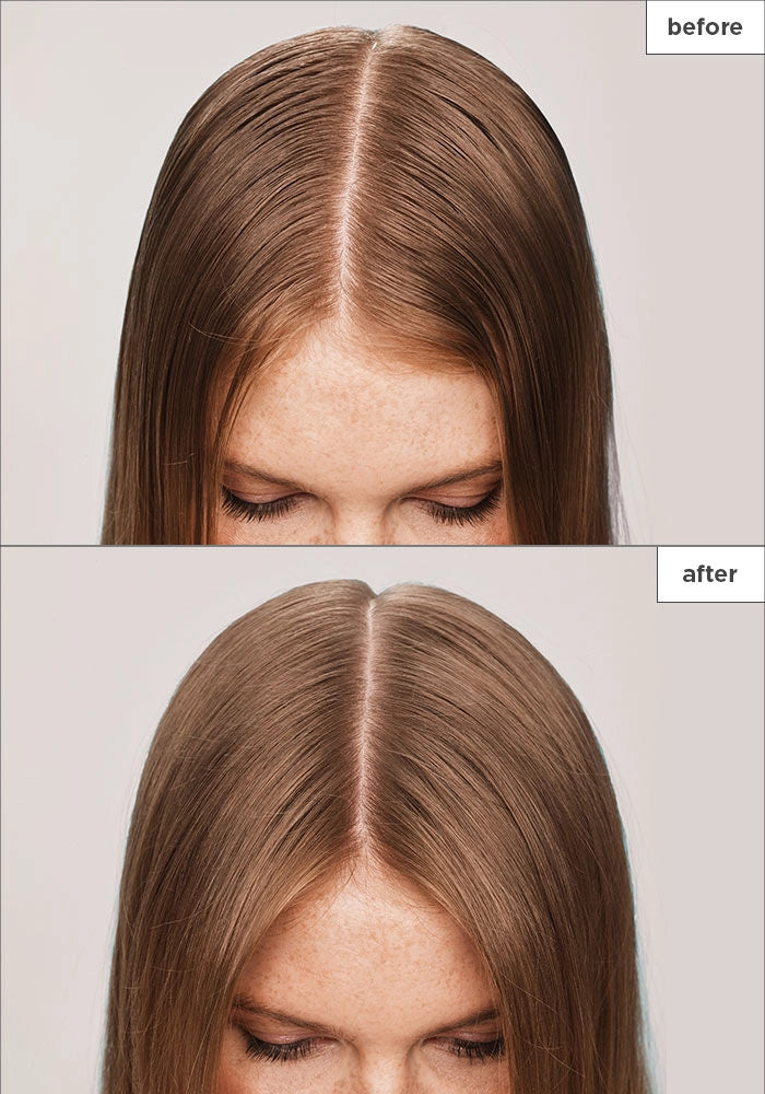 Briogeo Scalp Revival Charcoal + Tea Tree Scalp Treatment